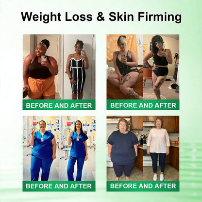 𝑶𝒇𝒇𝒊𝒄𝒊𝒂𝒍 𝑺𝒕𝒐𝒓𝒆  |🍀🍀𝐂𝐚𝐫𝐞𝐔𝐩𝐥𝐢𝐟𝐭® 𝑴𝒆𝒕𝒂𝒃𝒐𝒍𝒊𝒄 𝑵𝒂𝒏𝒐 𝑴𝒊𝒄𝒓𝒐𝒏𝒆𝒆𝒅𝒍𝒆 𝑷𝒂𝒕𝒄𝒉🇺🇸(𝐉𝐮𝐬𝐭 𝐨𝐧𝐜𝐞 𝐚 𝐝𝐚𝐲, 𝐯𝐢𝐬𝐢𝐛𝐥𝐞 𝐜𝐡𝐚𝐧𝐠𝐞𝐬 𝐢𝐧 𝟕 𝐝𝐚𝐲𝐬）𝘽𝙚𝙧𝙗𝙚𝙧𝙞𝙣𝙚 + 𝙈𝙤𝙧𝙞𝙣𝙜𝙖 𝙁𝙤𝙧𝙢𝙪𝙡𝙖 ✅ 𝐅𝐨𝐫 𝐨𝐛𝐞𝐬𝐢𝐭𝐲, 𝗟𝗼𝗼𝘀𝗲 𝘀𝗸𝗶𝗻,𝐝𝐢𝐚𝐛𝐞𝐭𝐞𝐬, 𝐬𝐥𝐞𝐞𝐩 𝐚𝐩𝐧𝐞𝐚, 𝐣𝐨𝐢𝐧𝐭 𝐢𝐬𝐬𝐮𝐞𝐬, 𝐚𝐧𝐝 𝐦𝐨𝐫𝐞💯